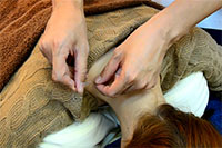 トリガーポイント鍼灸の特徴写真１